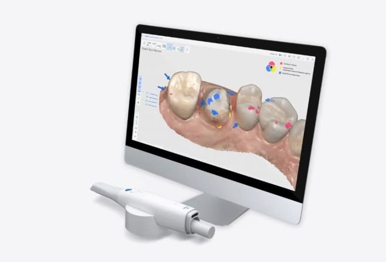 Medit Intraoral Scanner
